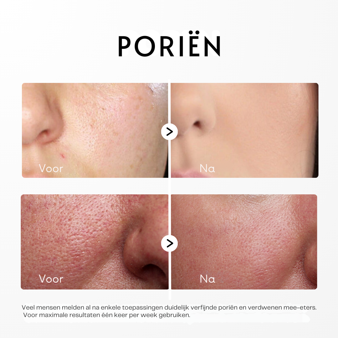 Dr. Melaxin - Peel shot voor gezonde Poriën.