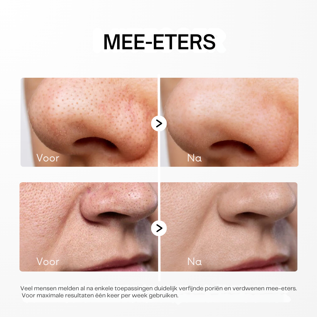 Dr. Melaxin - Peel shot voor gezonde Poriën.